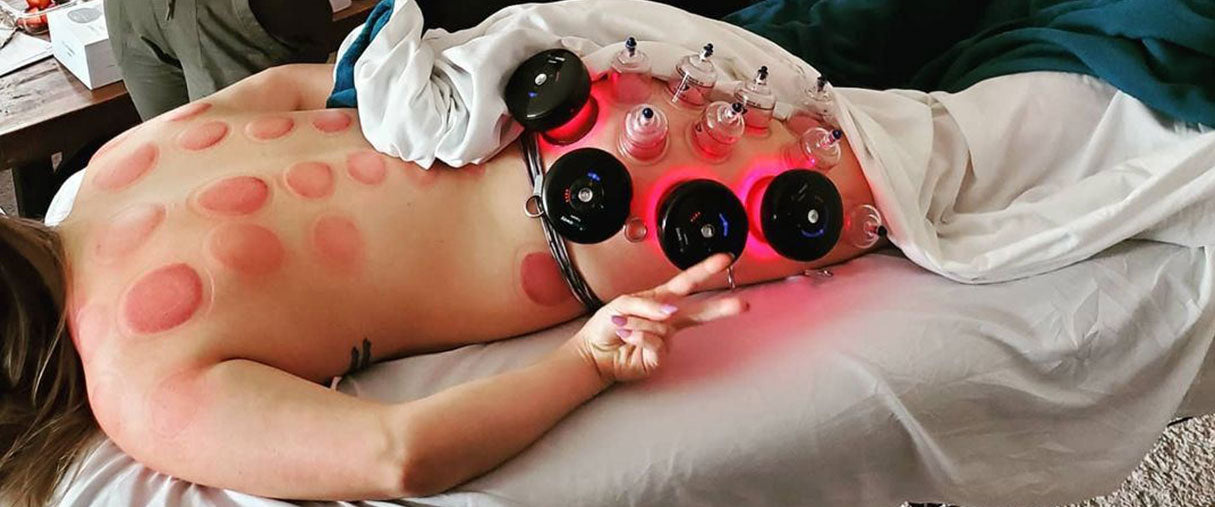 benefits of cupping massage