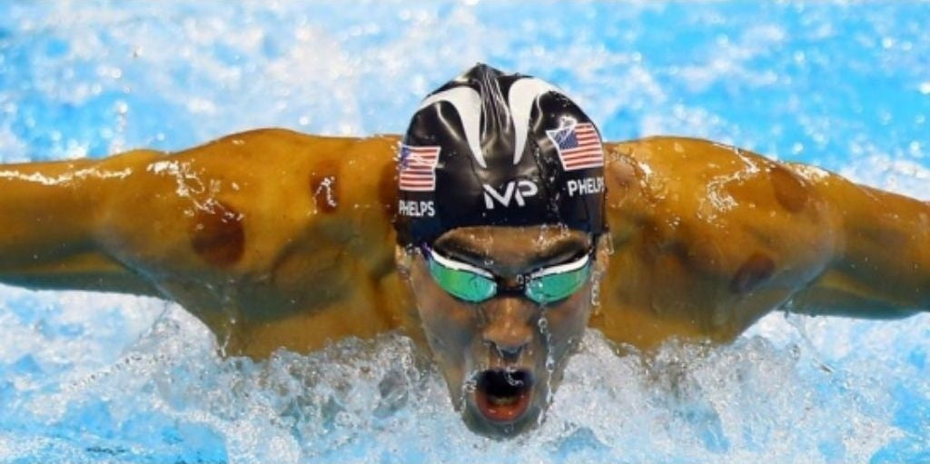 Michael Phelps cupping